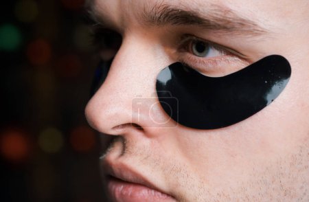 Photo for Man face with flakes under the eyes. Mans flakes. Patches under close eyes for man. Close-up of a young man with patches under eyes from wrinkles and dark circles - Royalty Free Image