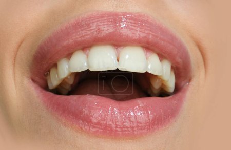 Zahnpflege, gesunde Zähne und Lächeln, weiße Zähne im Mund. Nahaufnahme eines Lächelns mit weißen gesunden Zähnen. Lächelnde Münder. Glück lachen und Mundwerk genießen