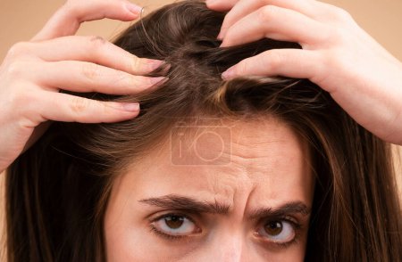 Foto de Pérdida de cabello de cerca. Problema enredado cabello macro - Imagen libre de derechos