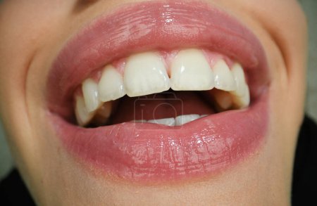 Smiling mouth. Dental care, healthy teeth and smile, white teeth in mouth. Closeup of smile with white healthy teeth