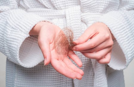 Foto de Problema de pérdida de cabello en la mano, aislado. Cabello dañado poco saludable en primer plano de la mano - Imagen libre de derechos