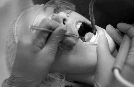 Foto de Dentista curando a una paciente en el consultorio dental en un ambiente agradable. Concepto de salud dental. Lámpara ultravioleta de relleno dental - Imagen libre de derechos