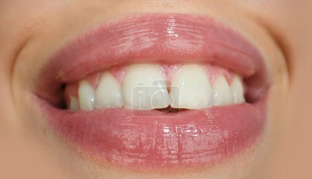 Dental care, healthy teeth and smile, white teeth in mouth. Closeup of smile with white healthy teeth. Open mouth