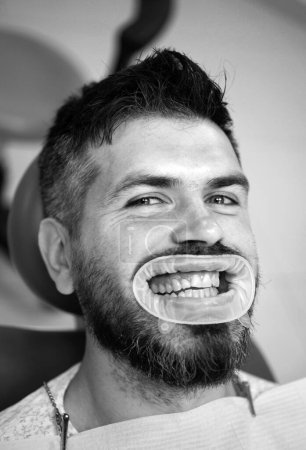 Foto de Hermosa sonrisa del hombre europeo con dientes sanos blanqueamiento. Dentista comparando blanqueamiento dental de su paciente en clínica dental. Dentista examinando los dientes de los pacientes en la clínica - Imagen libre de derechos