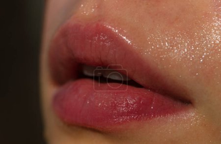 Téléchargez les photos : Gros plan sur les lèvres humides de la nature. Lèvres avec maquillage brillant. Injections de remplissage, chirurgie plastique, collagène et traitements - en image libre de droit