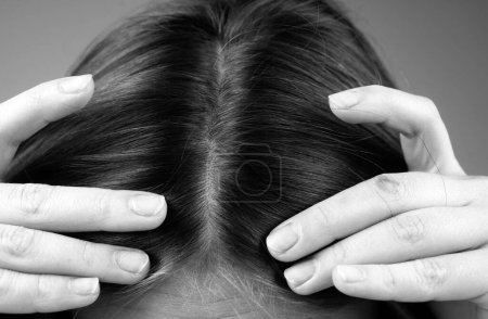 Téléchargez les photos : Femme inquiète pour la perte de cheveux. Problème de chute de cheveux - en image libre de droit