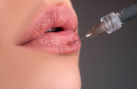 Photo for Lips augmentation. Syringe female mouth, hyaluronic acid injection. Age changes. Cosmetology Treatment - Royalty Free Image