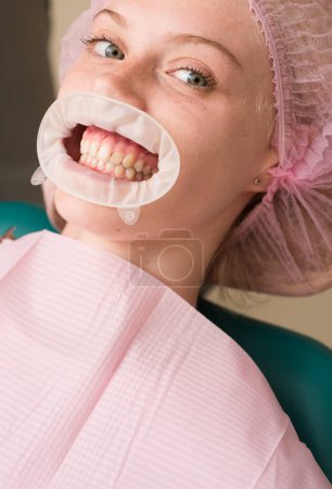 Foto de Joven hembra rubia abriendo la boca mientras que dentista no identificable en guantes de látex comprobar el estado de sus dientes. Mujer feliz sonriendo sobre un fondo abstracto con luces borrosas - Imagen libre de derechos