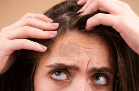 Téléchargez les photos : Triste femme avec problème de perte de cheveux inquiet de la perte de cheveux - en image libre de droit