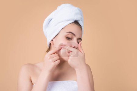 Photo for Close up Woman squeeze out pimples on cheek. Acne and pimple on skin. Dermatology, puberty woman. Pimples problem skin. Girl Squeeze out Pimple on skin cheek. Care from skin problem. Pimple face - Royalty Free Image