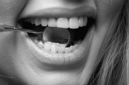Téléchargez les photos : Les dents du dentiste se reflètent en gros plan. Examen des dents avec miroir dentaire. Hygiène dentaire. Clinique dentaire. Remplissage des dents. Dents examinées chez le dentiste. Dents de femme en bonne santé et miroir buccal dentiste - en image libre de droit