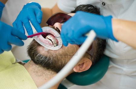 Photo for Beautiful european man smile with healthy teeth whitening. Close up of men patient with beard with open mouth sitting in medical chair and doctor with assistant making teeth check up in dental clinic - Royalty Free Image