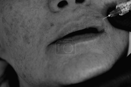 Foto de Inyecciones de relleno. Los labios maduros de la mujer del primer plano, aumento del procedimiento. Jeringa de boca femenina, inyección de ácido hialurónico, aumento. Cambios de edad. Cosmetología Tratamiento - Imagen libre de derechos