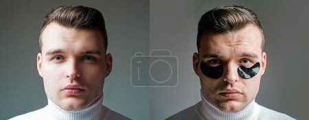 Photo for Before and after result. Minimizes puffiness and reduce dark circles. Eye patches for men. Man with black eye patches close up. Metrosexual concept. Focused treatments for under eye area. Skin care. - Royalty Free Image