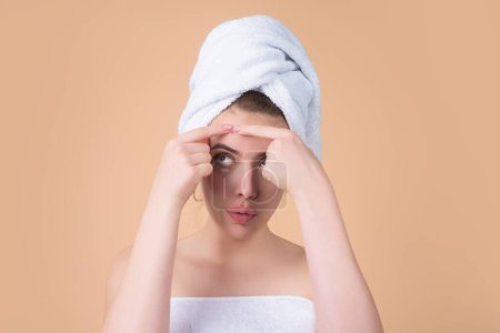 Photo for Woman squeeze out pimples on forehead. Acne and pimple on skin. Dermatology, puberty woman. Pimples problem. Girl Squeeze out Pimple on face. Care from skin problem. Pimple face - Royalty Free Image