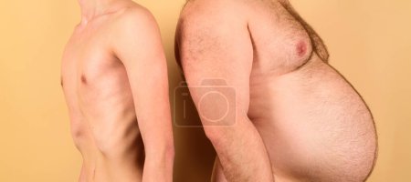 Photo for Man before and after weight loss. Unhealthy lifestyle - Royalty Free Image