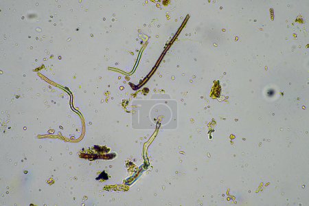 Photo for Microorganisms and soil biology, with nematodes and fungi under the microscope. in a soil and compost sample in spring - Royalty Free Image
