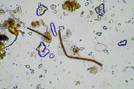 Bodenprobe unter dem Mikroskop. Bodenpilze und Mikroorganismen, die im Frühjahr Nährstoffe im Kompost sammeln