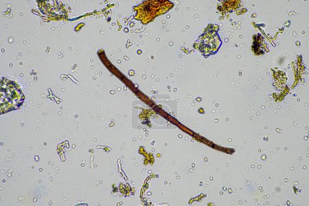Téléchargez les photos : Échantillon de sol au microscope. champignons du sol et microorganismes cyclisant les nutriments dans le compost au printemps - en image libre de droit