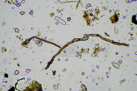 Foto de Muestra de suelo bajo el microscopio. hongos y microorganismos del suelo que producen nutrientes en el compost en primavera - Imagen libre de derechos