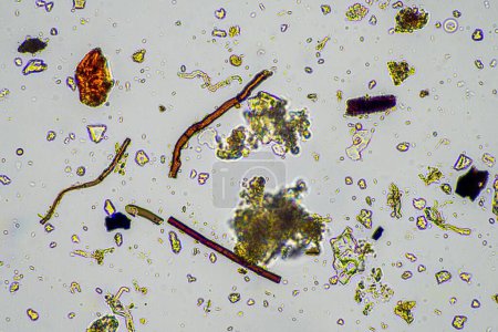 Téléchargez les photos : Micro-organismes et biologie du sol, avec nématodes et champignons au microscope. dans un échantillon de sol et de compost au printemps - en image libre de droit