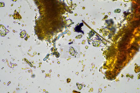 Foto de Microorganismos y biología del suelo, con nematodos y hongos bajo el microscopio. en una muestra de suelo y compost en primavera - Imagen libre de derechos