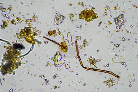 Foto de Microorganismos del suelo, con hifas de hongos del suelo creciendo en el compost en una granja que es orgánica - Imagen libre de derechos