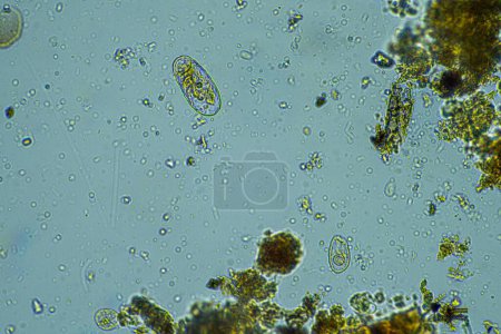Photo for Human parasites in the human gut health - Royalty Free Image
