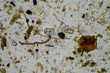 Foto de Microorganismos del suelo en una muestra de suelo, hongos y bacterias del suelo en una granja regenerativa en compost. hifas de hongos en una prueba de suelo. en Australia - Imagen libre de derechos