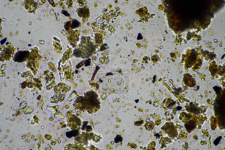micro-organismes du sol dans un échantillon de sol, champignon du sol et bactéries sur une ferme régénérative dans le compost. "fungi hyphae in a soil test". en Australie