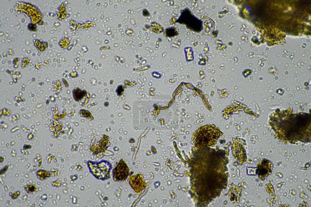 Foto de Soil microorganisms in a soil sample, soil fungus and bacteria on a regenerative farm in compost. fungi hyphae in a soil test. in australia - Imagen libre de derechos