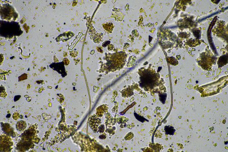Téléchargez les photos : Micro-organismes du sol dans un échantillon de sol, champignon du sol et bactéries sur une ferme régénérative dans le compost. "fungi hyphae in a soil test". en Australie - en image libre de droit