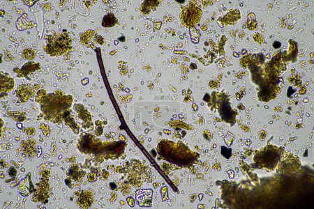 Bodenmikroorganismen in einer Bodenprobe, Bodenpilze und Bakterien auf einem regenerativen Bauernhof im Kompost. Pilze hyphen bei einem Bodentest. in Australien