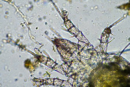 Téléchargez les photos : Microorganismes du sol, y compris les nématodes, les microarthropodes, les microarthropodes, les tardives et les rotifères un échantillon de sol, des champignons du sol et des bactéries sur une ferme régénérative en compost sous le microscope en Australie - en image libre de droit