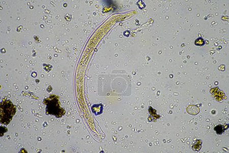 microorganismos del suelo, incluidos nematodos, microartrópodos, microartrópodos, tardígrados y rotíferos: una muestra de suelo, hongos y bacterias del suelo en una granja regenerativa de compost bajo el microscopio en Australia