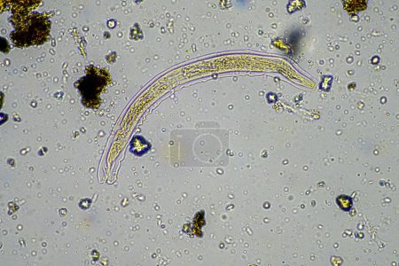 Photo for Soil microorganisms including nematode, microarthropods, micro arthropod, tardigrade, and rotifers a soil sample, soil fungus and bacteria on a regenerative farm in compost under the microscope in australia - Royalty Free Image