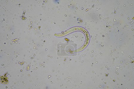 Photo for Microorganisms and soil biology, with nematodes and fungi under the microscope in a soil compost sample - Royalty Free Image