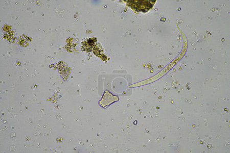 Foto de Microorganismos y biología del suelo, con nematodos y hongos bajo el microscopio en una muestra de compost de suelo - Imagen libre de derechos
