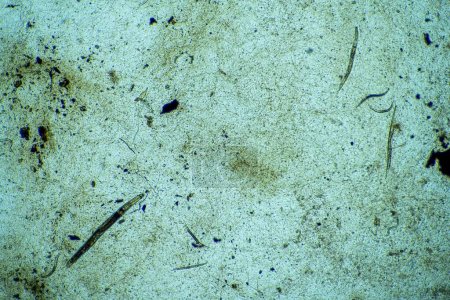 nematodo bajo el microscopio en un laboratorio