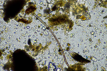 Foto de Agrónomo con una muestra de suelo con vida de suelo e insectos. microorganismos que almacenan carbono con hongos y bacterias de una granja - Imagen libre de derechos