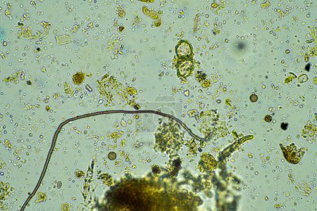 Téléchargez les photos : Micro-organismes au microscope à un grossissement 400x dans un échantillon - en image libre de droit