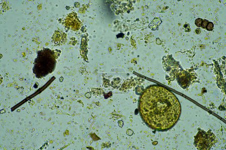 Foto de Arcella, hongos y nematodos en una muestra de suelo de una explotación de Australia - Imagen libre de derechos