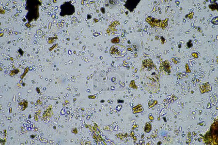 Téléchargez les photos : Les micro-organismes du sol se ferment sous le microscope. dans un échantillon de sol provenant d'une ferme - en image libre de droit