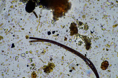 Foto de Vida del suelo bajo el microscopio con hongos e hifas fúngicas en una granja - Imagen libre de derechos