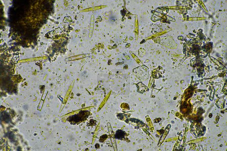 Photo for Soil microorganisms close up under the microscope. in a soil samlple from a farm - Royalty Free Image