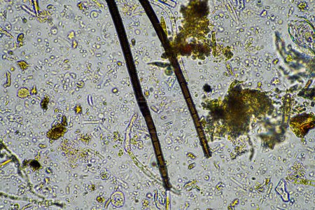 Foto de Vida del suelo bajo el microscopio con hongos e hifas fúngicas en una granja - Imagen libre de derechos