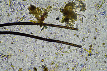 Téléchargez les photos : Les micro-organismes du sol se ferment sous le microscope. dans un échantillon de sol provenant d'une ferme - en image libre de droit