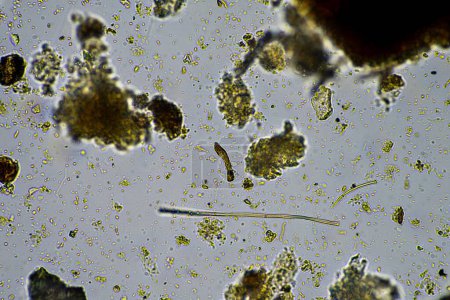 Téléchargez les photos : Champignons et micro-organismes du sol dans un échantillon de sol et de compost - en image libre de droit