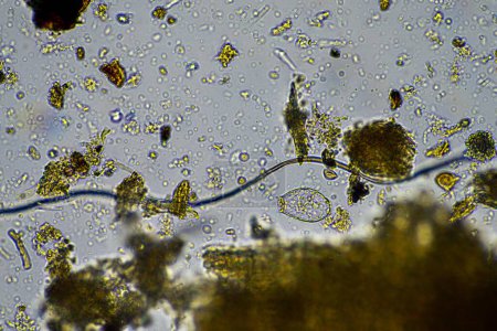 Téléchargez les photos : Les micro-organismes du sol se ferment sous le microscope. dans le sol d'une ferme - en image libre de droit
