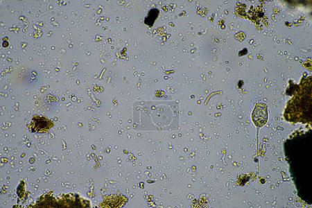 Foto de Parásito humano. enfermedad de la infección intestinal intestinal. infección por microorganismos - Imagen libre de derechos